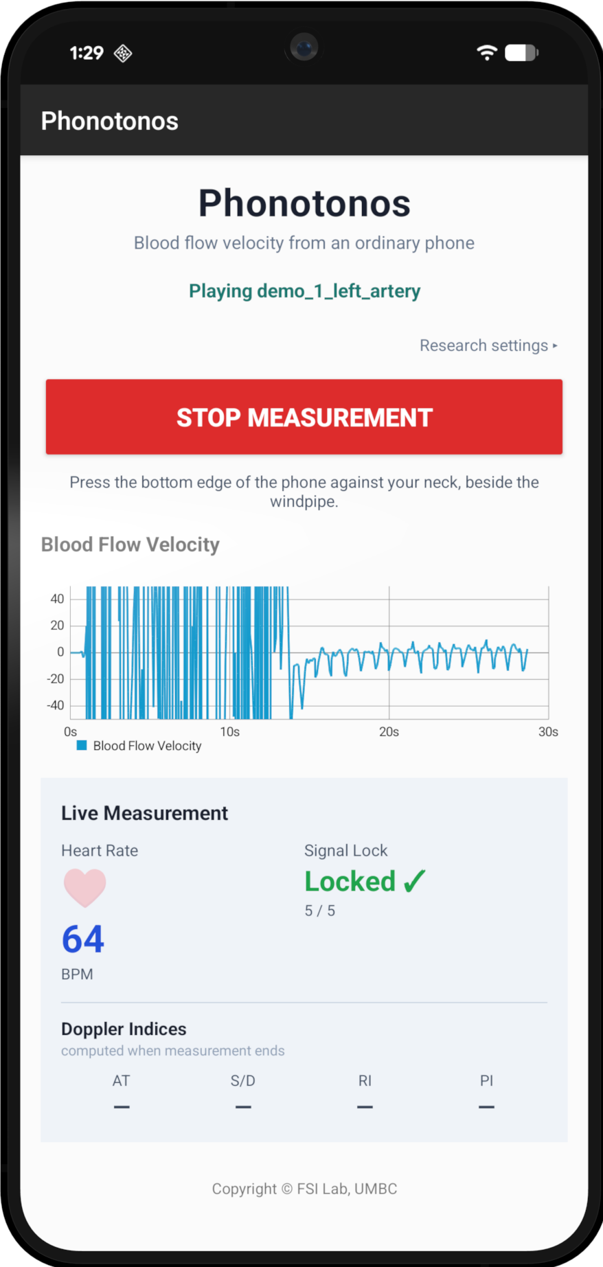 The application at the moment the artery is located, drawing the live blood-flow waveform.