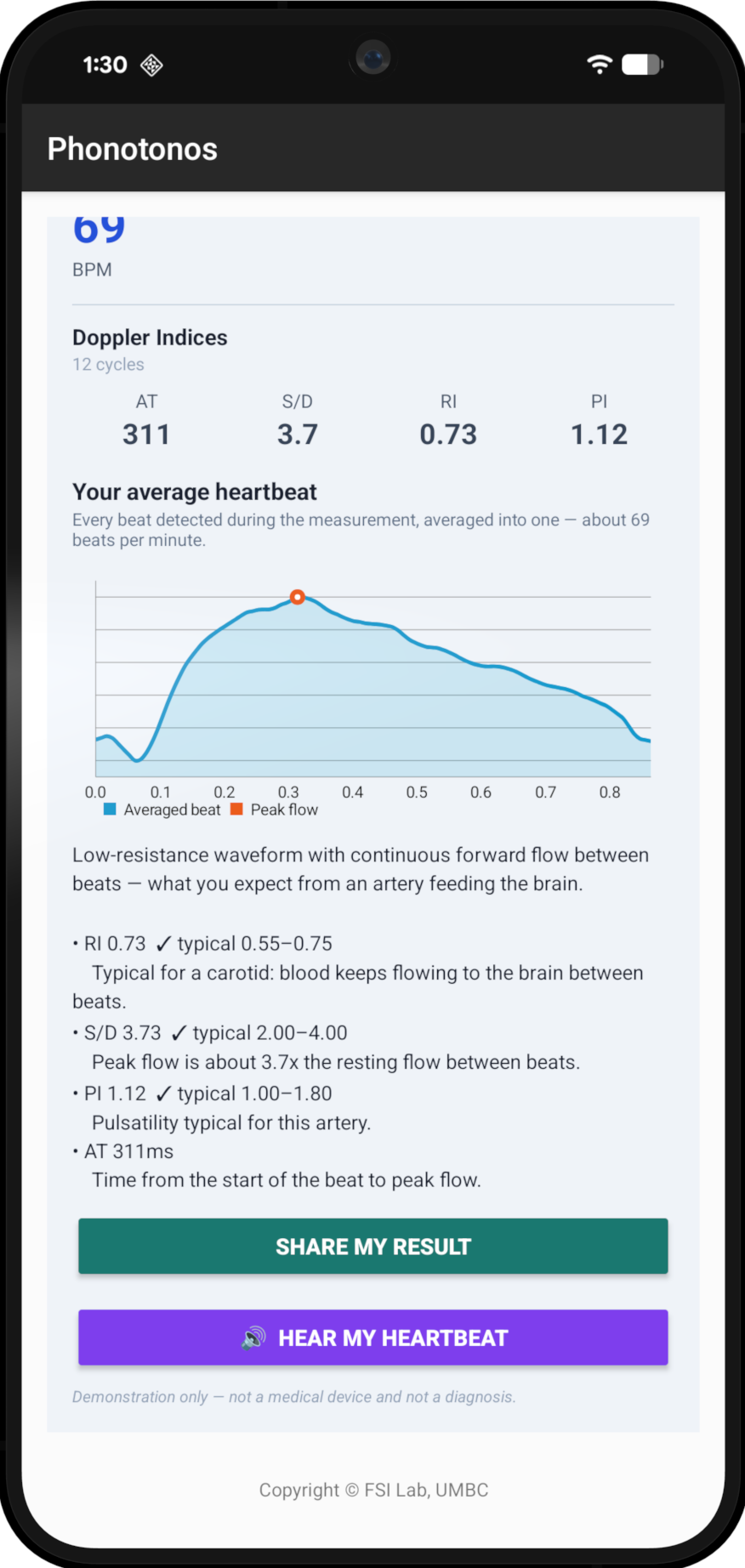 The application result screen, showing the averaged cardiac cycle and the four Doppler indices.